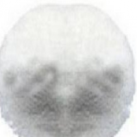 Barium nitrate Barium nitrate