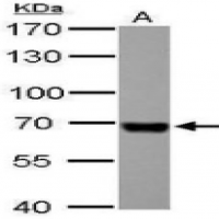 Serum Albumin Serum Albumin