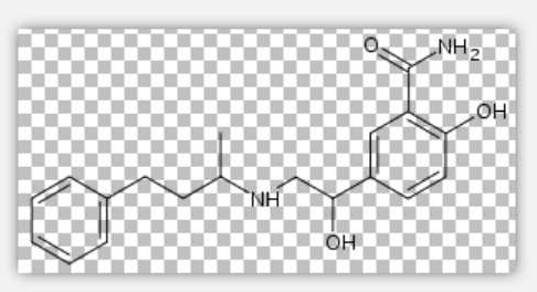 Labetalol Labetalol