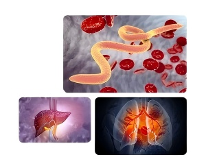Albendazole over the counter​