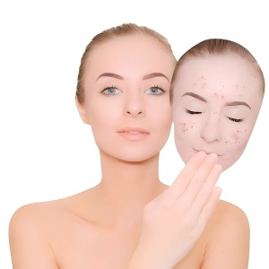 Acetyl dipeptide-3 aminohexanoate:Microbiome balance support Acetyl dipeptide-3 aminohexanoate:Microbiome balance support