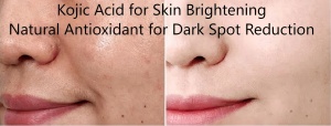 Kojic Acid for Skin Brightening|Natural Antioxidant for Dark Spot Reduction Kojic Acid for Skin Brightening|Natural Antioxidant for Dark Spot Reduction