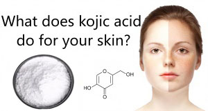 What does kojic acid do for your skin? What does kojic acid do for your skin?