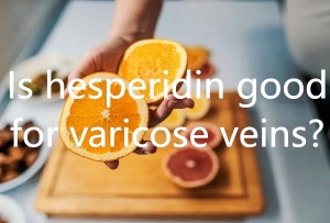 Is hesperidin good for varicose veins? Is hesperidin good for varicose veins?